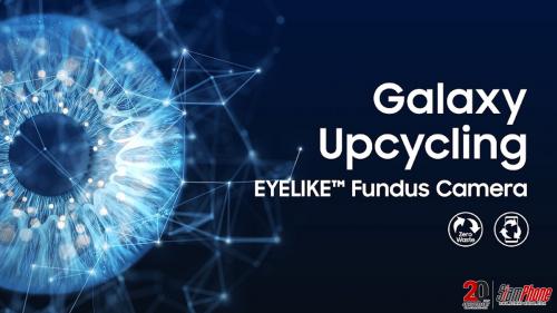 ย้อนความสำเร็จในโครงการผลิตเครื่องตรวจจอประสาทตา EYELIKE จาก Samsung 